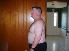 274 pounds-day of surgery
2/22
