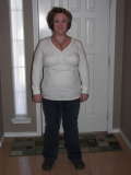 Nov 2008
Down 50 lbs
7 months post-op