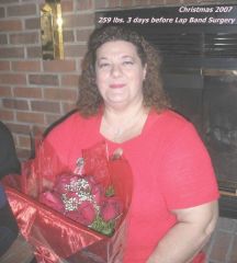 Christmas 2007
3 days before lapband surgery 256 lbs.