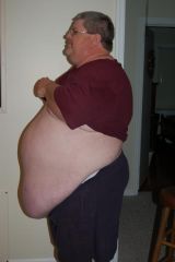 4 weeks befor surgery .. started at 478 pounds . this pic i was at 441 pounds . on my suger buster diet ..
