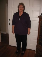 picture prior to weight loss and day of pre-op