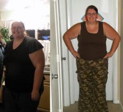 The picture on the left was taken in April 2010, about 2 weeks before my surgery.

Picture on the right taken June 12, 2010. 40 pounds lighter!