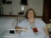 this me when iam recovry from the sugery for the lapband in may 22 /09
