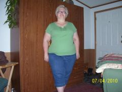 July 4th, 2010 - 3 weeks after surgery - down 10 lbs since surgery, 40 lbs total.