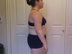 July 8, 2010 - One Month After Surgery