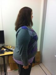 4 mo 280 terrible side view! 65 down