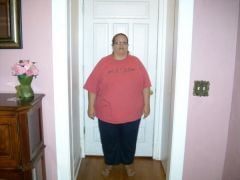 Front view!  9-7-10, surgery date Oct. 7, 2010!  Weight 336#'s!