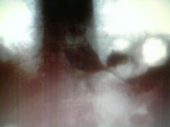 Darker image of possible prolapse.