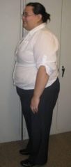 3 Months Post Op
86 pounds gone as of 11-12-2010.