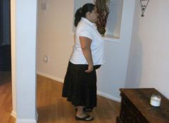 Sept 20th 2010
Before being Banded
Weight 253
Lost: 15 pounds