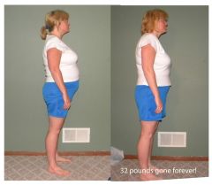 32 Pounds Gone Forever!