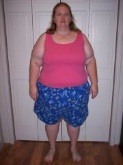 8-8-08 4 days post-surgery 
296 lbs/8 lbs lost from pre-surgery