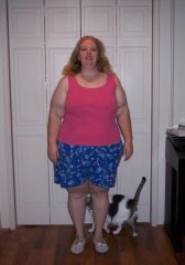 11-8-08 3 months after surgery
258.8 lbs/45.2 lbs lost