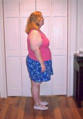 11-8-08 3 months after surgery
258.8 lbs/45.2 lbs lost