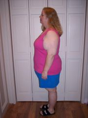 2-7-09 6 months after surgery
244 lbs/60 lbs lost