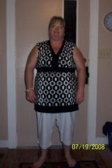 Before surgery
254 lbs