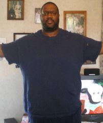 front view 49 days post-op. 60lbs down