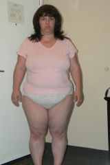 This is me the night before my banding...
March 5 08. 247lbs