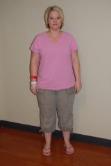 Post-op Day 1: 5-28-08. Front view. I look miserable here. 172 pounds.