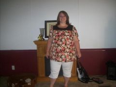 me 9 days post op.  I have lost 26 lbs and am now in twoterville