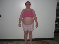 Feb 25th 2012 Day After Surgery