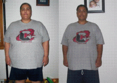 Front View Comparison - 55 lbs lost
