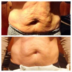 Before & Afters - The Ultimate Body Applicator