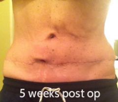 5 weeks tummy