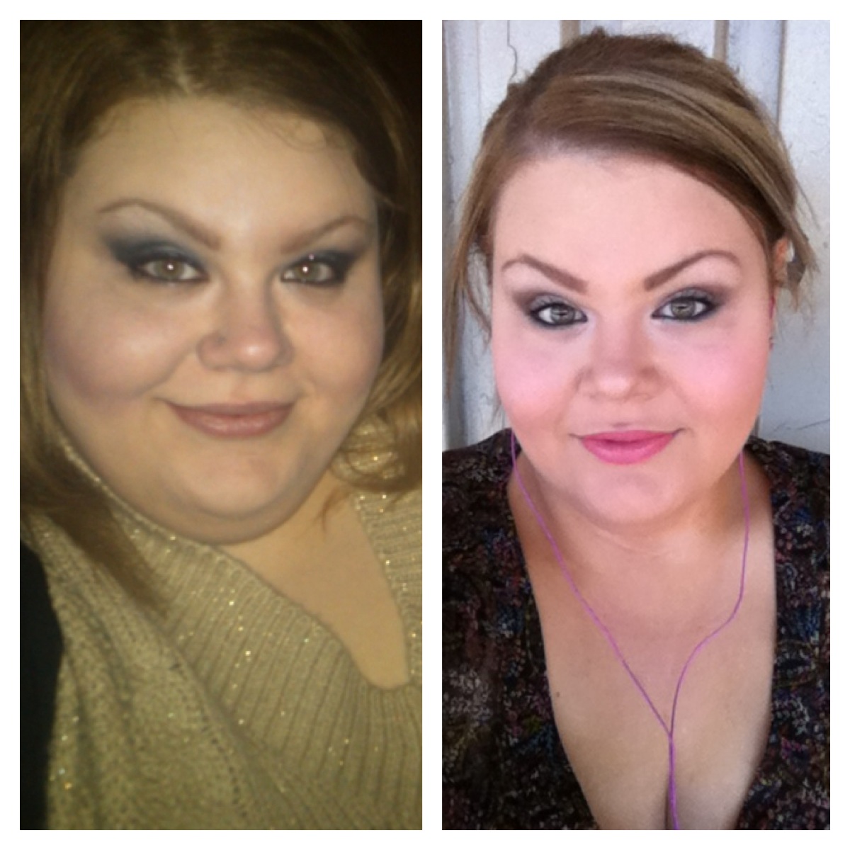 Facial Features Change After Weight Loss POST Operation Weight