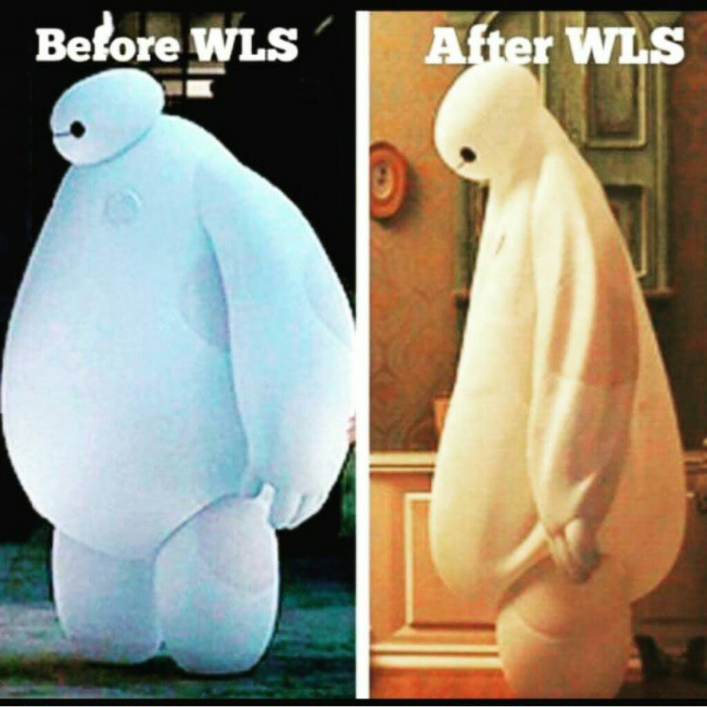 Funny WLS memes - Gastric Sleeve Surgery Forums - BariatricPal