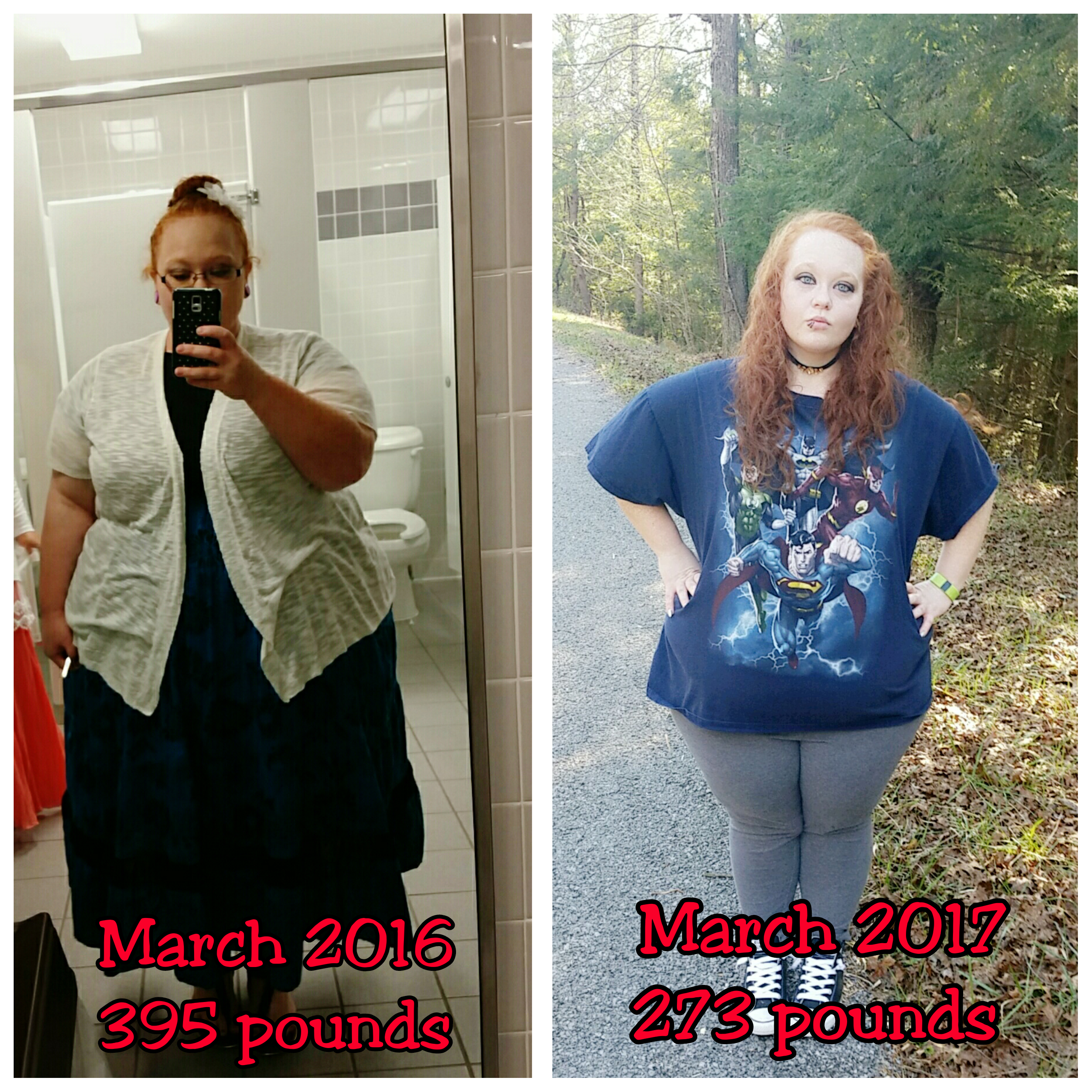 Almost down 150 pounds - 6 months post op - Tell Your Weight Loss Surgery  Story - BariatricPal