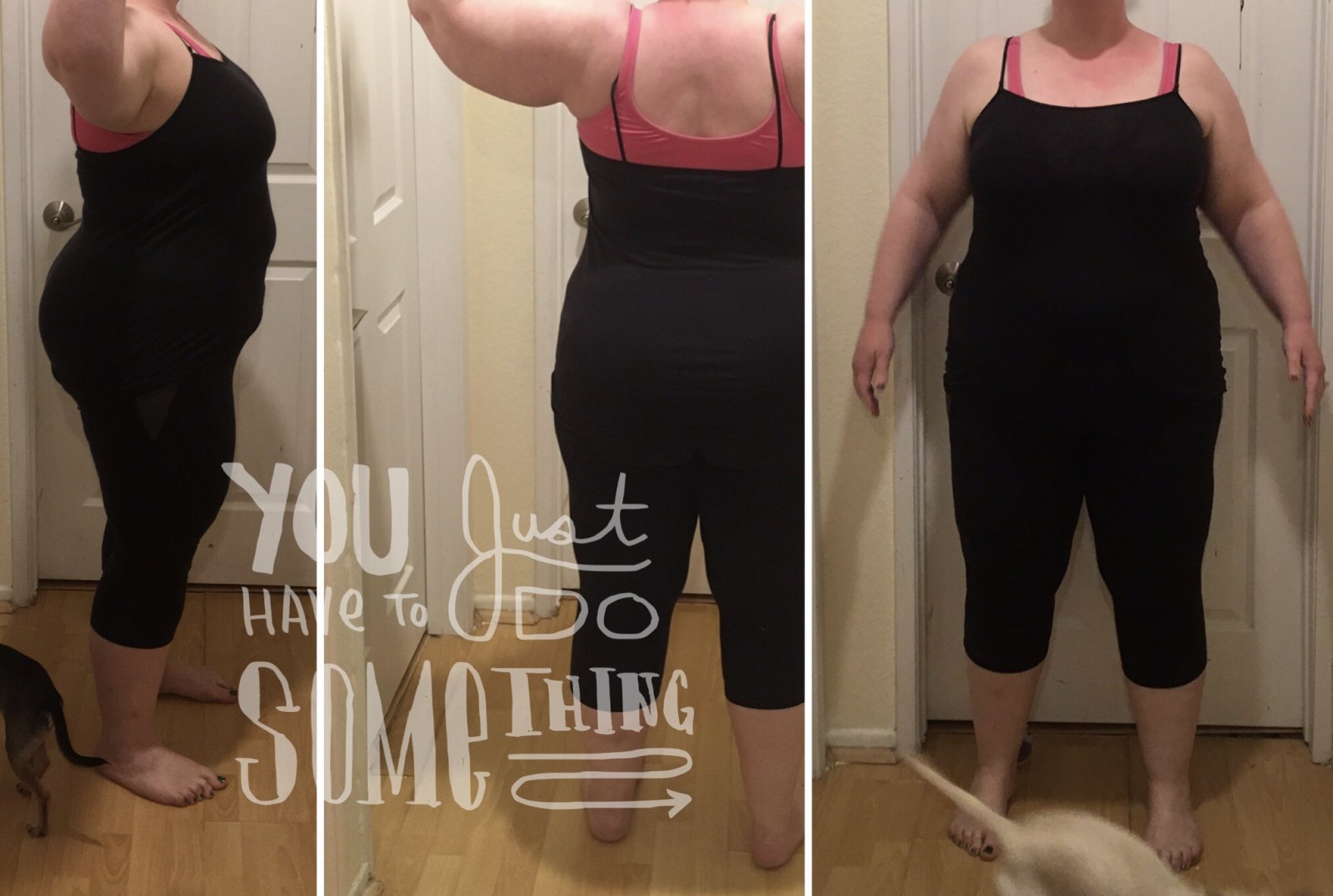 Night Before Surgery Post Liquid Diet Before And After Gastric 