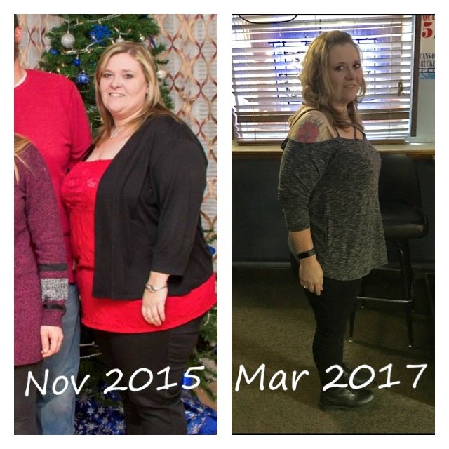 6 Months Post Op Gastric Bypass BariatricPal