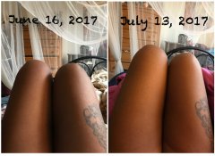 Before and current leg photo