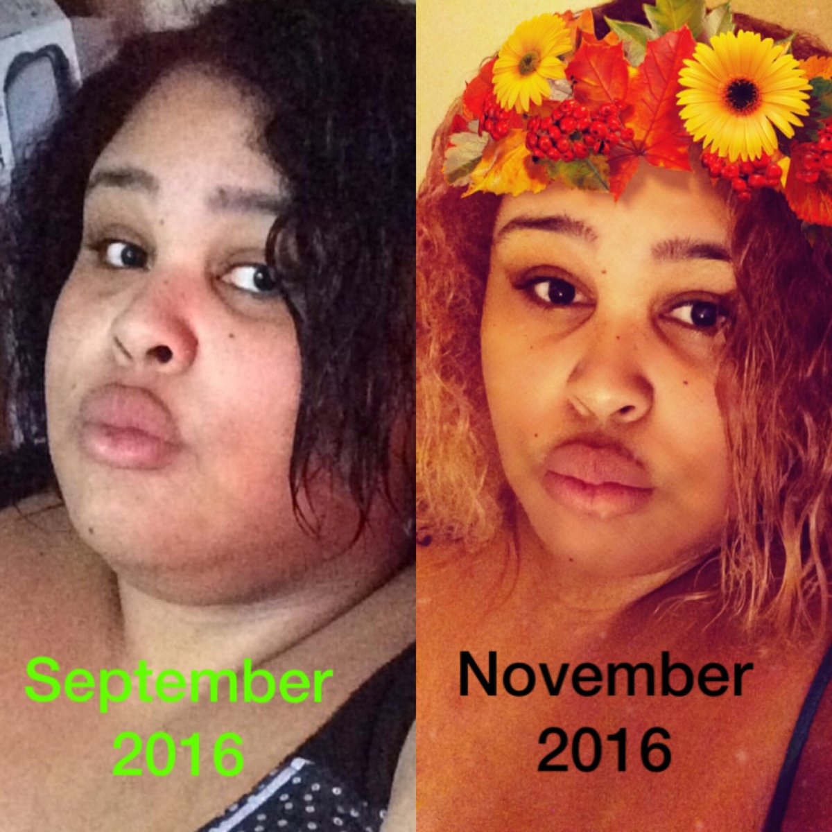 My Journey to health before photos
