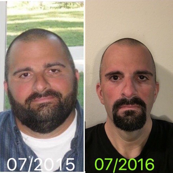 My Before and After Pics