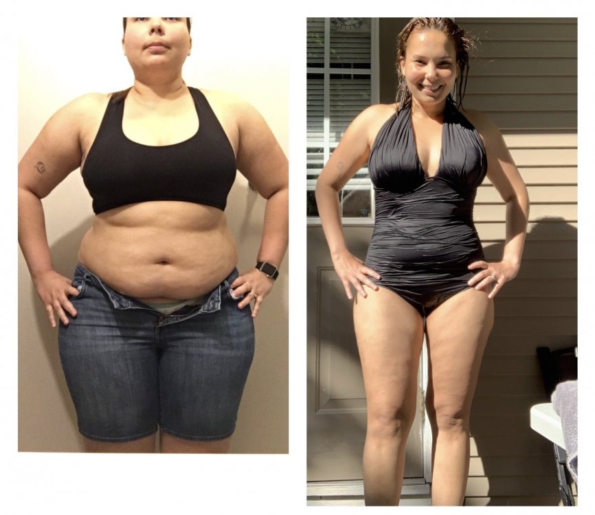 Before And After Pics Page Post Operation Weight Loss Surgery Q