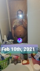 AFTER surgery Feb 10th, 2021