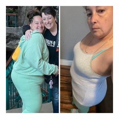 21 days after surgery 30lbs lost