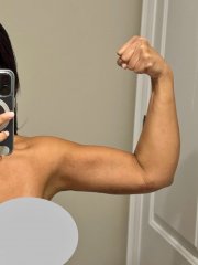 4 years, 3 months AFTER arm lift