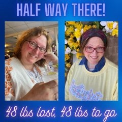 Before and After Gastric Bypass Photos