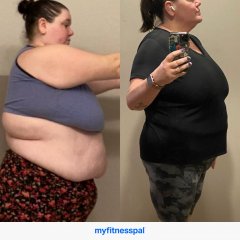Before and After Gastric Sleeve Photos