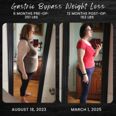 Weight Comparison From Start to 12 months.png