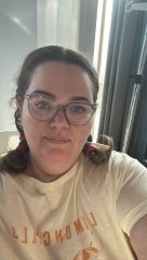 Before and After Gastric Bypass Photos