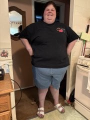 Before Gastric Sleeve